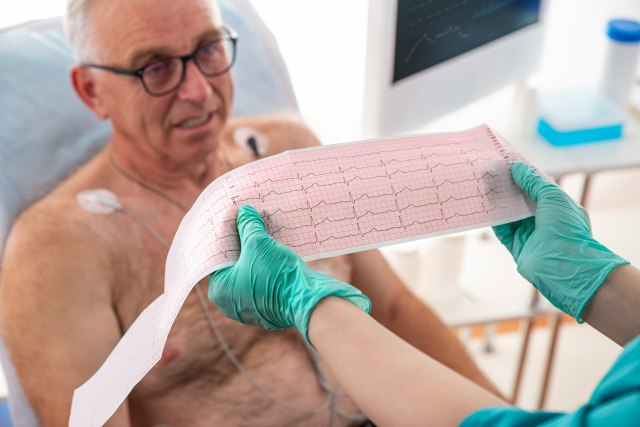 Crna statistika u Srbiji: Od srèanih oboljenja premine 51.000 ljudi godišnje VIDEO